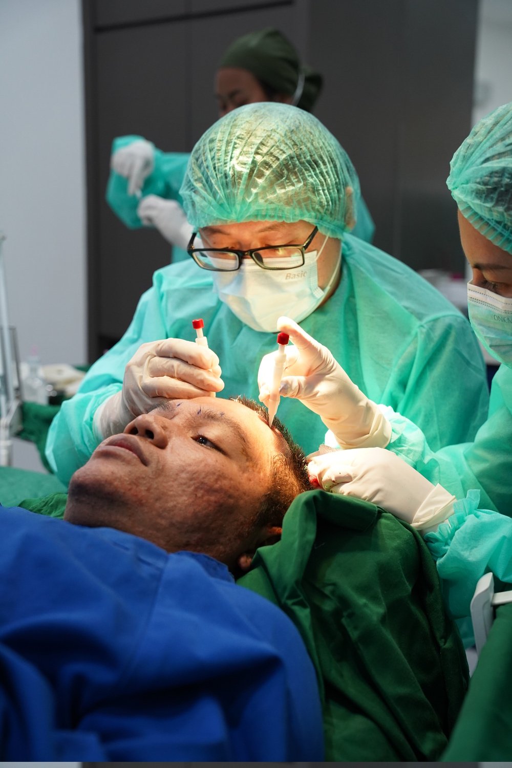 Integrafts hair transplant procedure