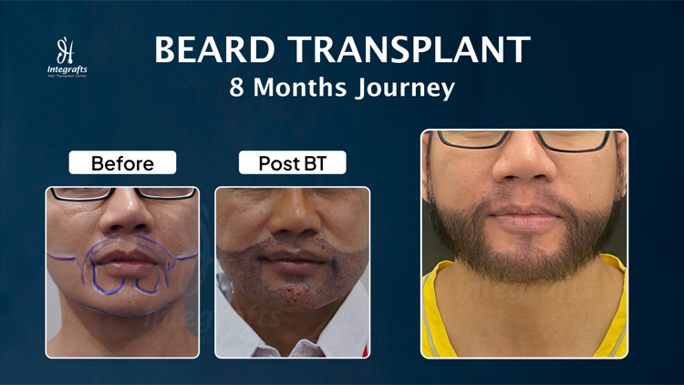 Hasil treatment