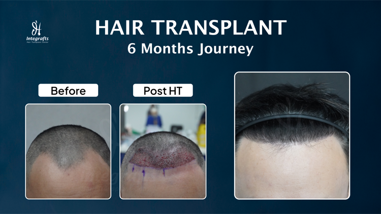 Hasil treatment