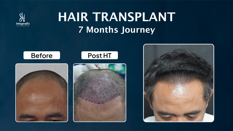 Hasil treatment