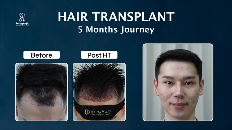 Hasil treatment
