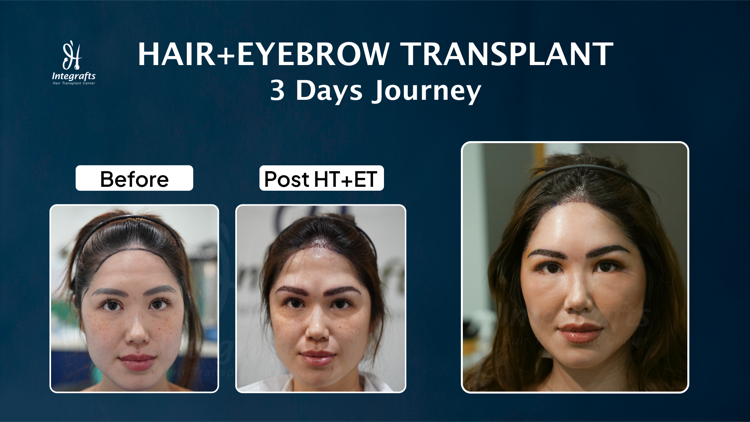 Hasil treatment