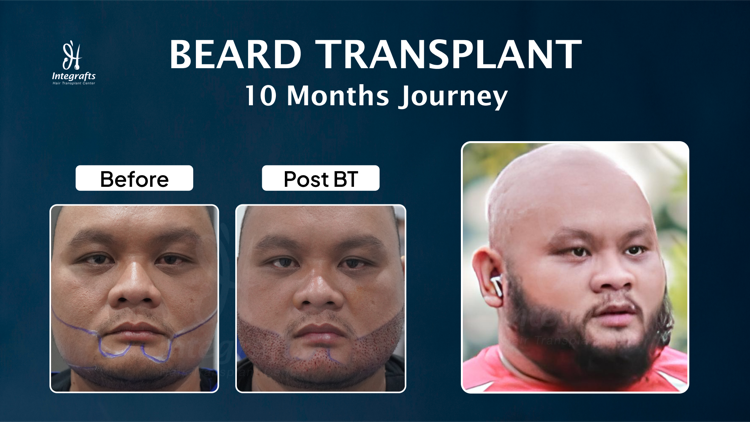 Hasil treatment