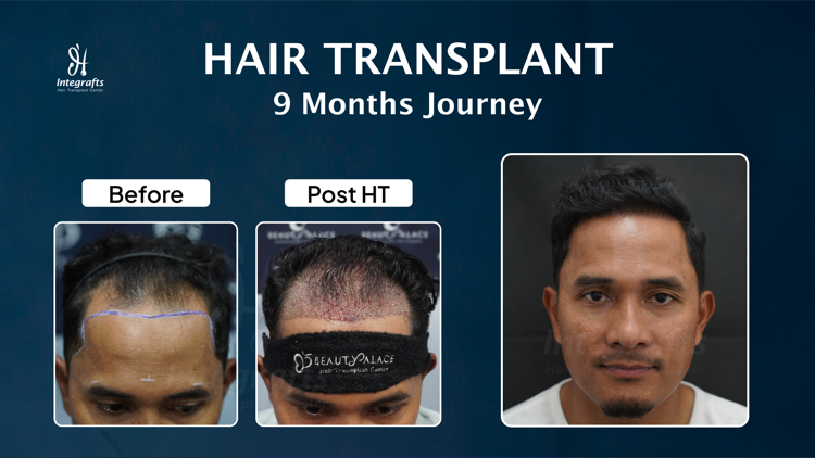 Hasil treatment