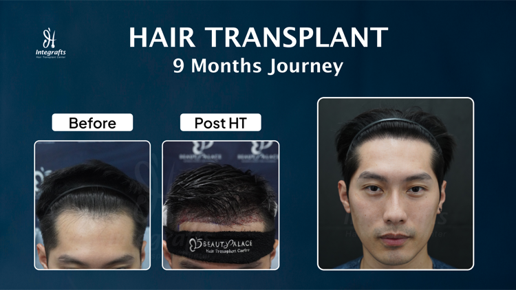 Hasil treatment