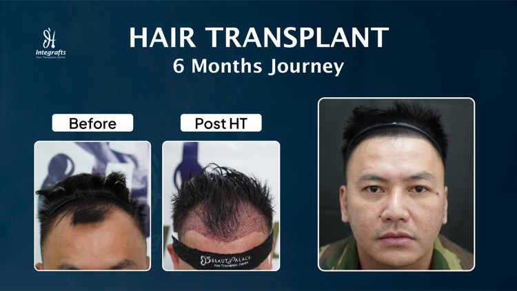 Hasil treatment