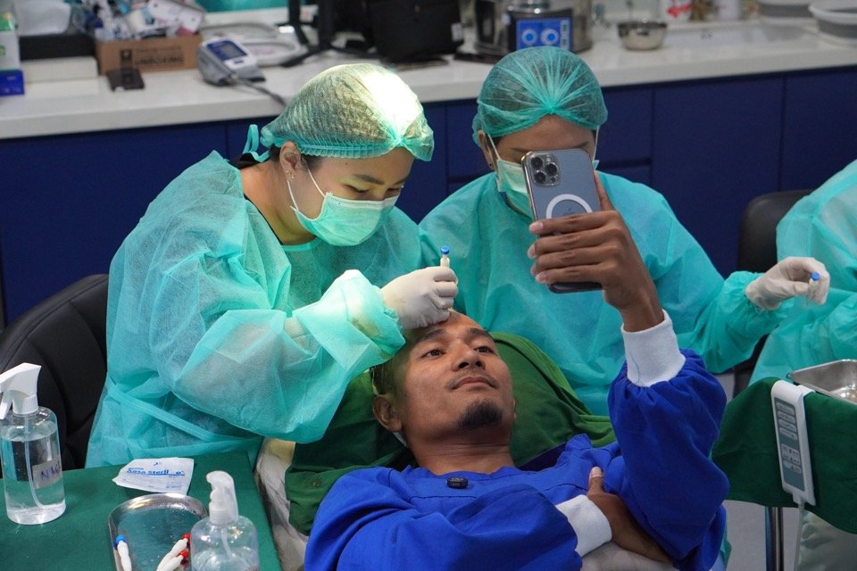 Integrafts hair transplant procedure
